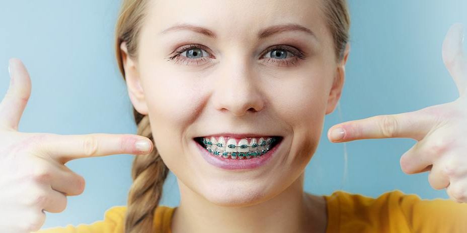 Read more about the article Braces for Busy Schedules: How to Make Time for Orthodontic Appointments