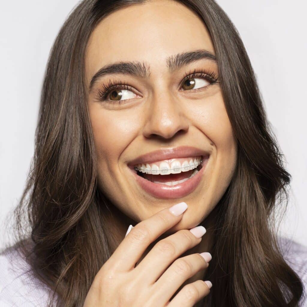 Smiling young woman with ceramic braces showing how orthodontic treatment can enhance teeth alignment and facial appearance.