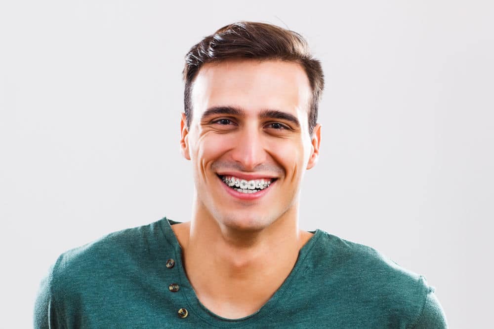 Read more about the article How Long Do Clear Aligners Take to Work Compared to Braces?