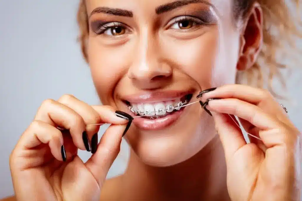 Person wearing metal braces while using dental floss to clean between teeth.