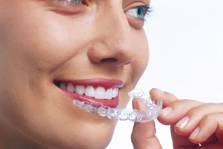 Close-up of a patient holding clear Invisalign aligners, illustrating the importance of proper aligner fit and tooth movement tracking during orthodontic treatment.